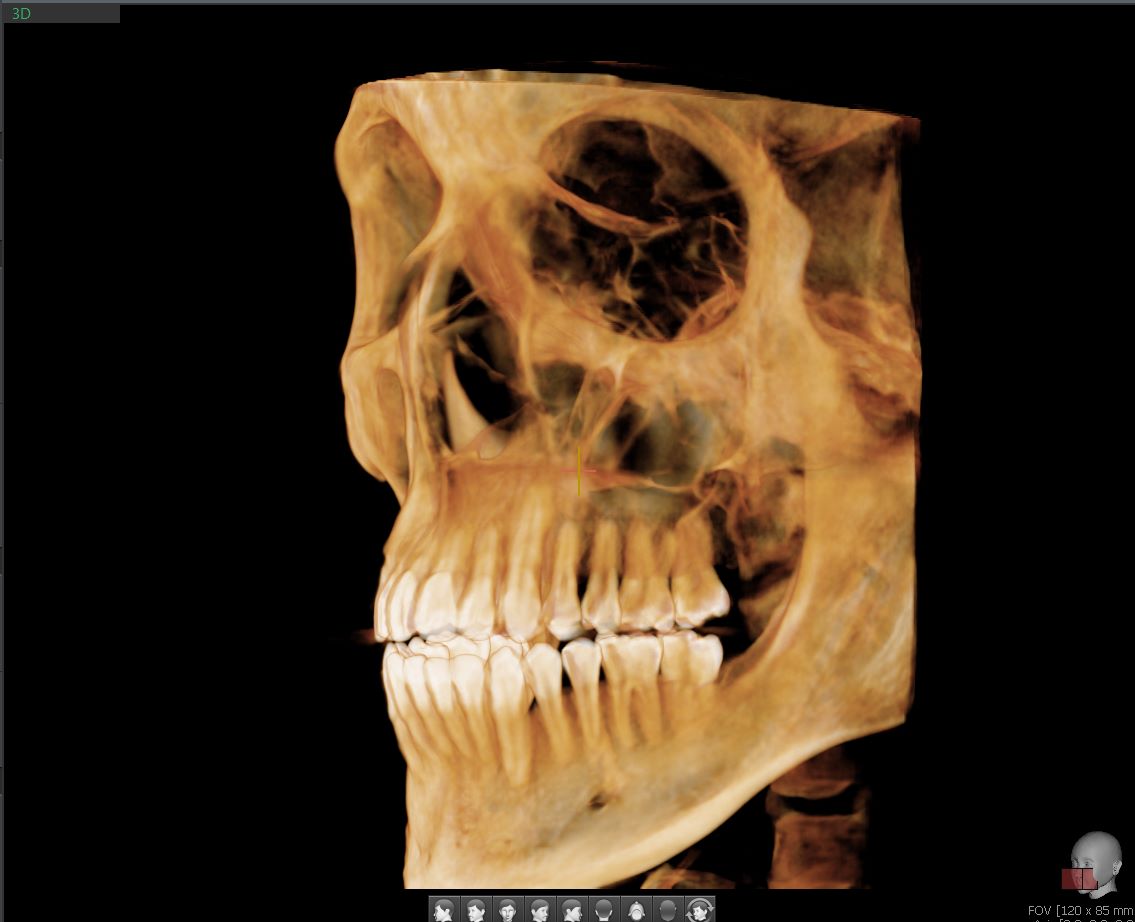 Tomógrafo Dental Vatech Green X12 - FOV 12 X 14 cm -2